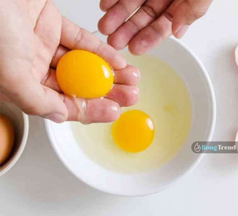Dandruff Problem Home Remedy খুশকি সমস্যা প্রতিকার Egg Yolk চুলের খুশকি দূর করার উপায়