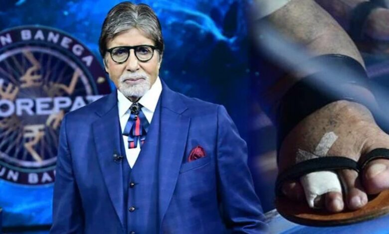 Amitabh Bacchan fracture in toe