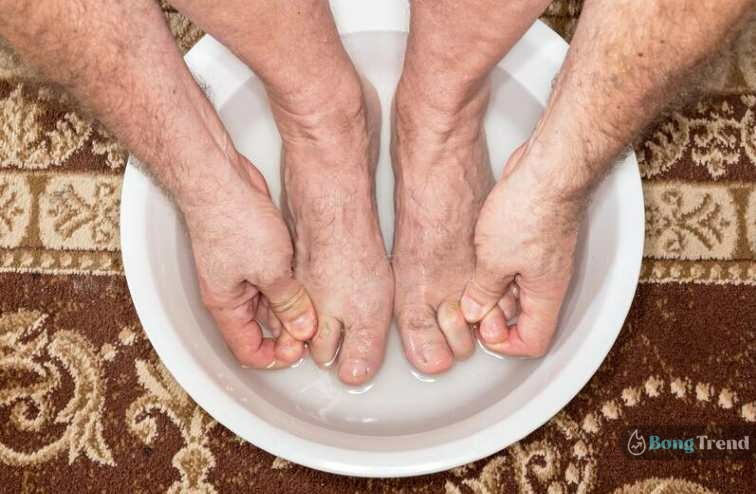 Cracked Feet Home Remedy,Skin Care Tips,শীতে ত্বকের যত্ন,শীতে পায়ের যত্ন,ফাটা গোড়ালি সারানোর উপায়,ফাটা গোড়ালির প্রতিকার,লাইফস্টাইল,Lifestyle