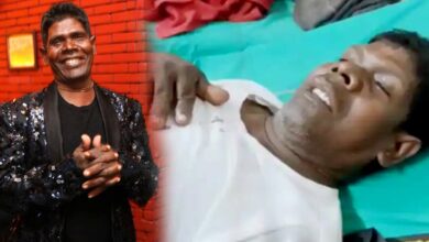 Kacha Badam singer Bhuban Badyakar Accident admitted to hospital