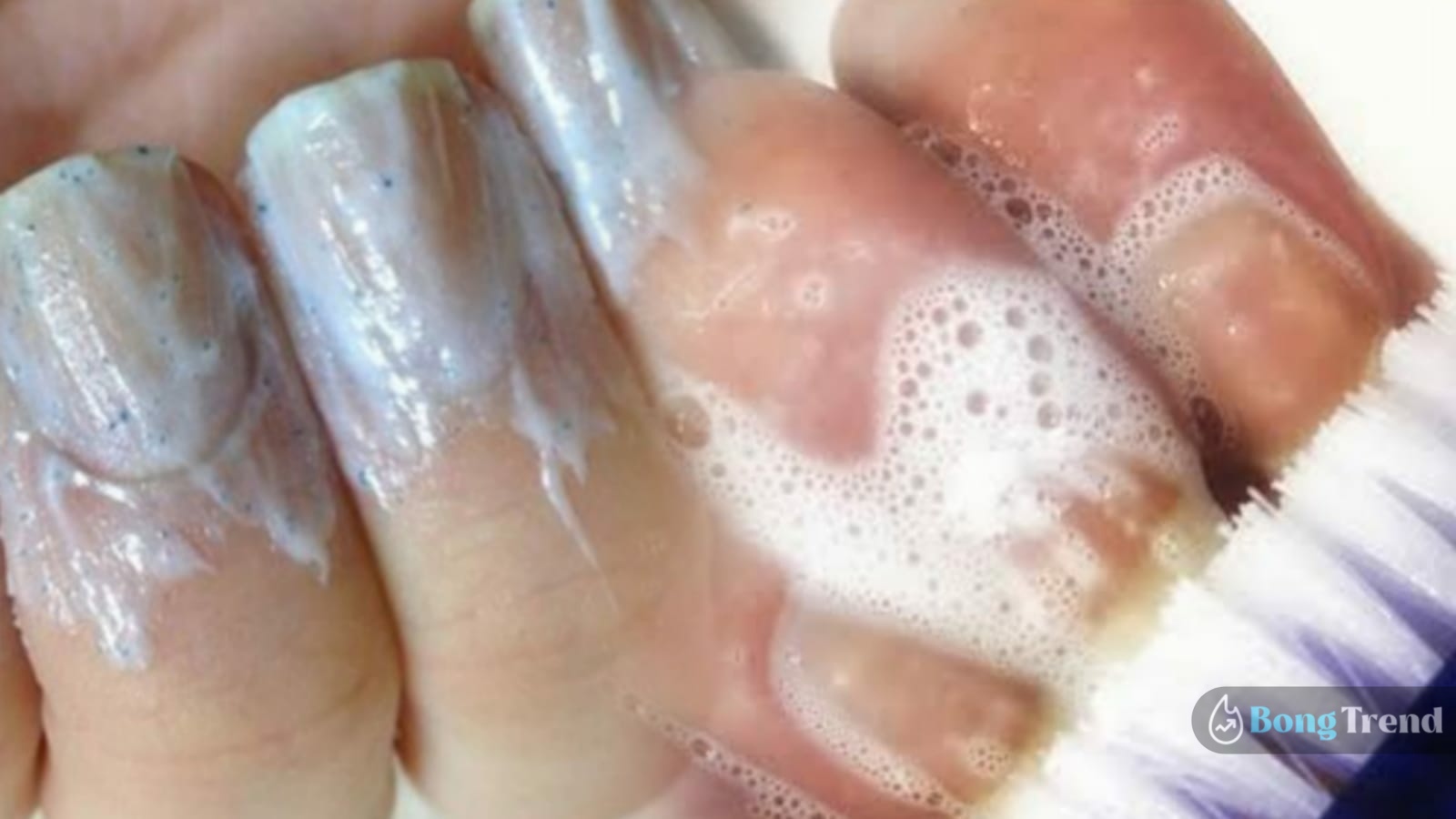 How To Strengthen Weak And Brittle Nails Naturally At Home