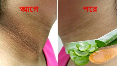 remove black spots from neck home remedy