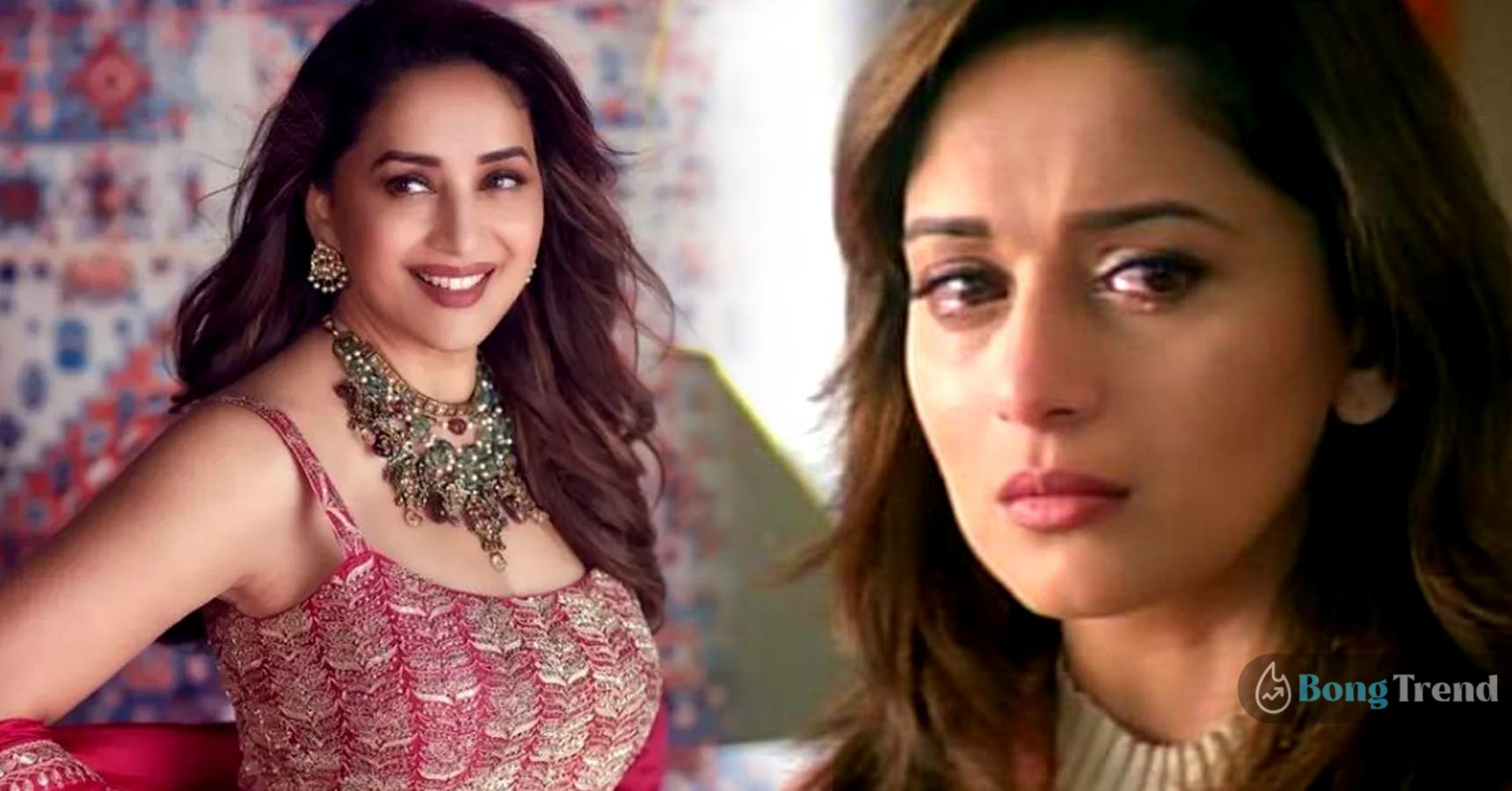 Madhuri Dixit gets trolled for doing lip surgery