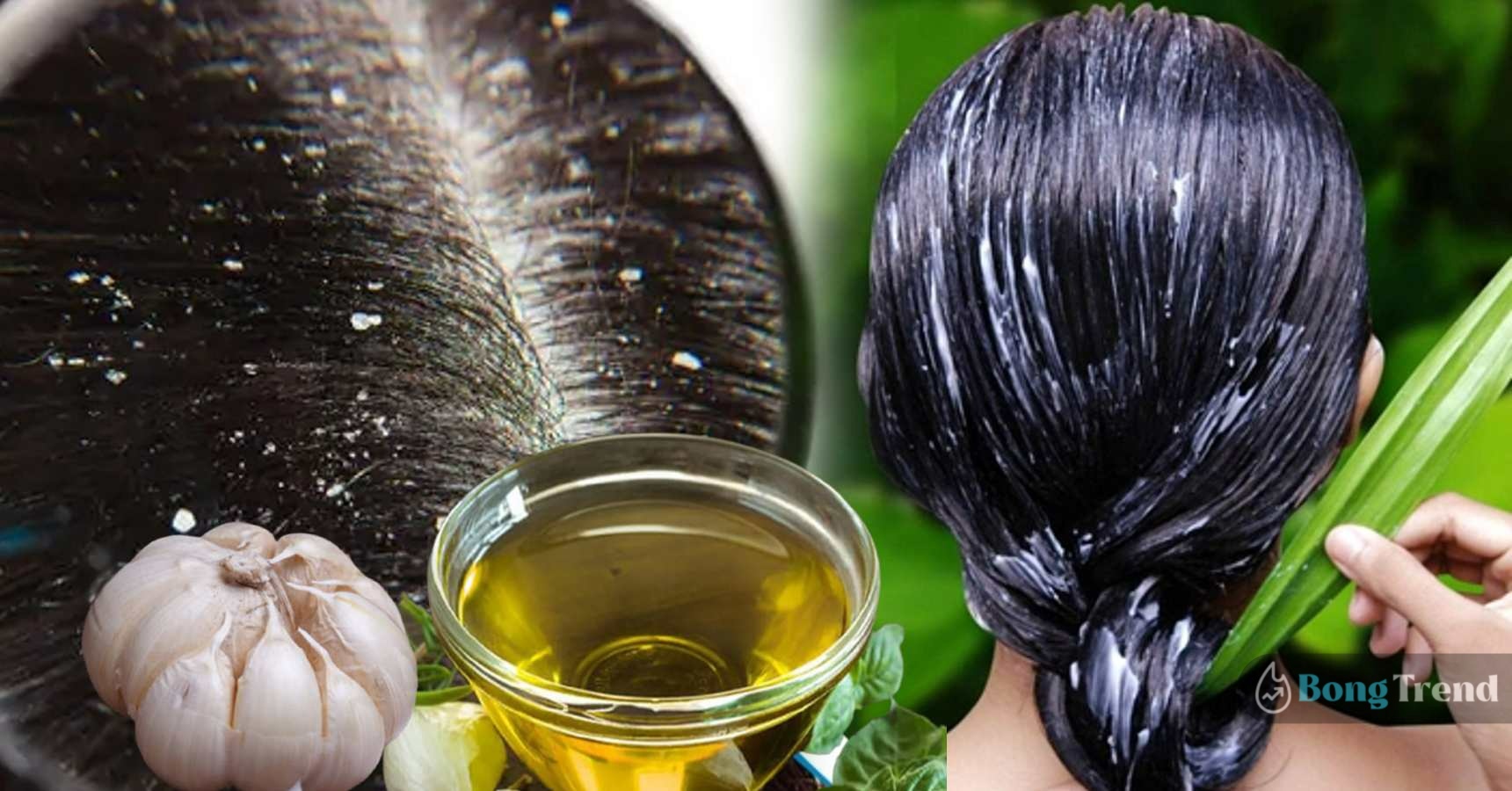 remove dandreff from hair with garlic oil once a week