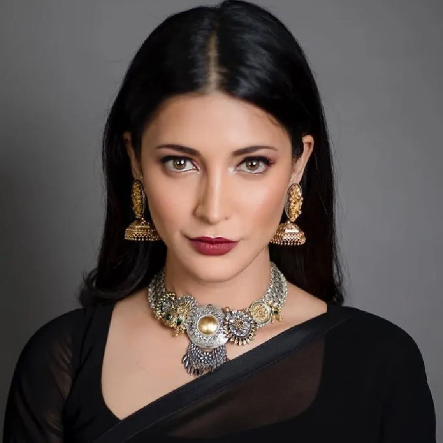 Shruti Haasan, Shruti Haasan disease