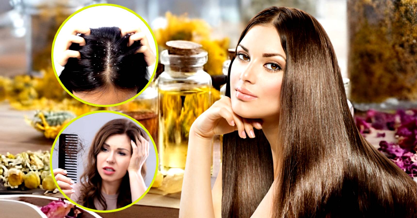 4 easy hair care tips in monsoon to prevent hair fall and dandruff