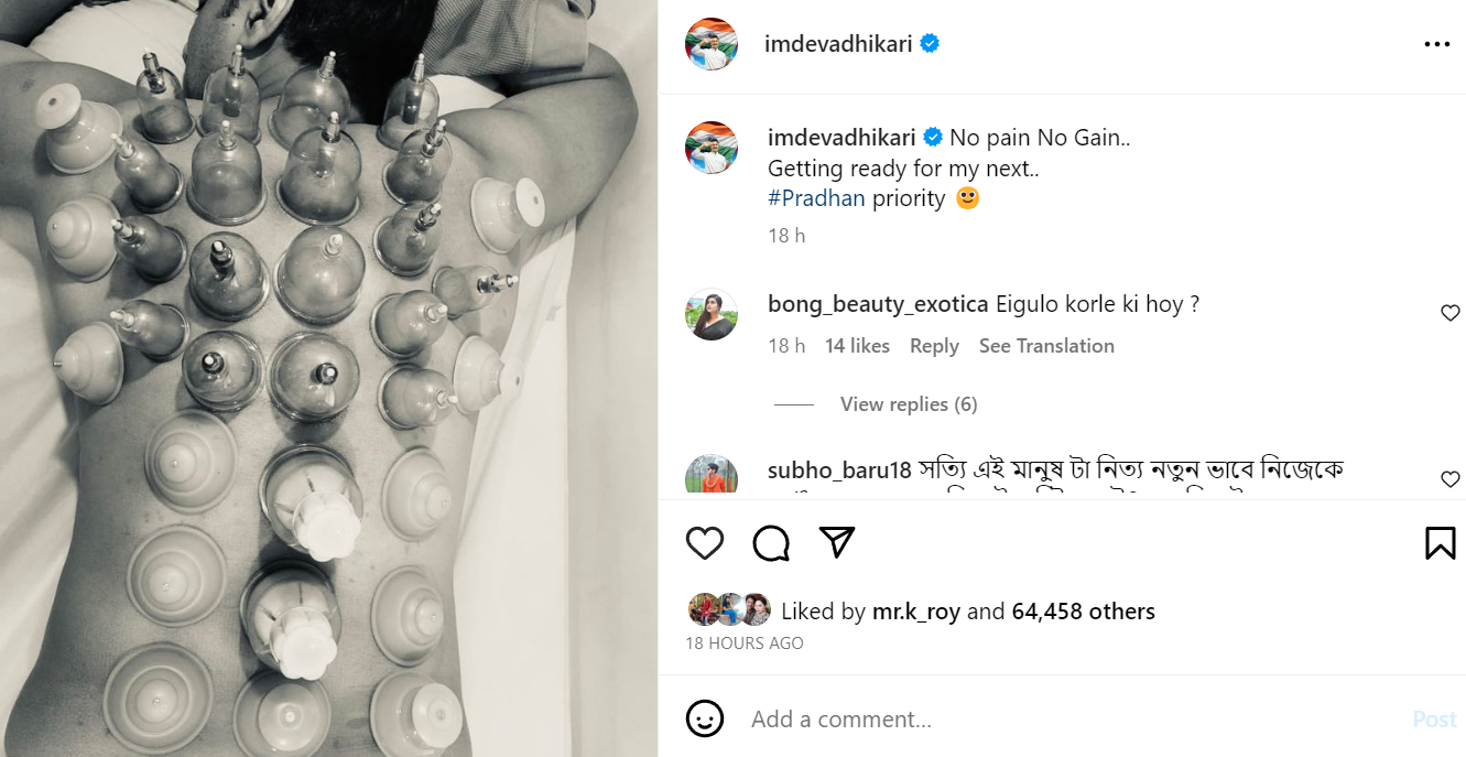 Tollywood superstar Dev Adhikari's cup therapy photo goes viral