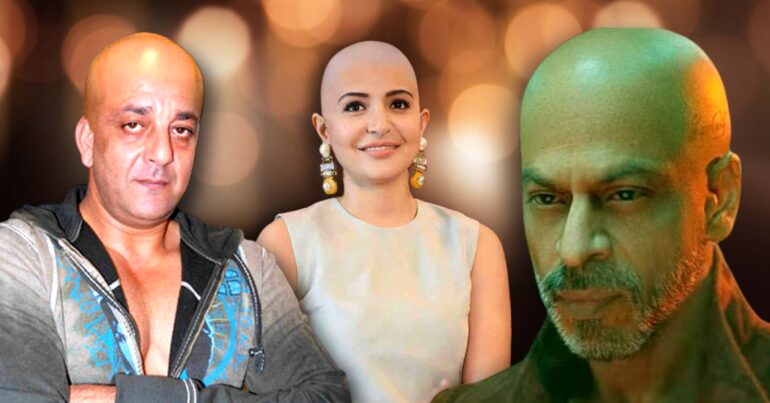 Shahrukh Khan to Anushka Sharma 6 Bolyywood stars who bald on screen