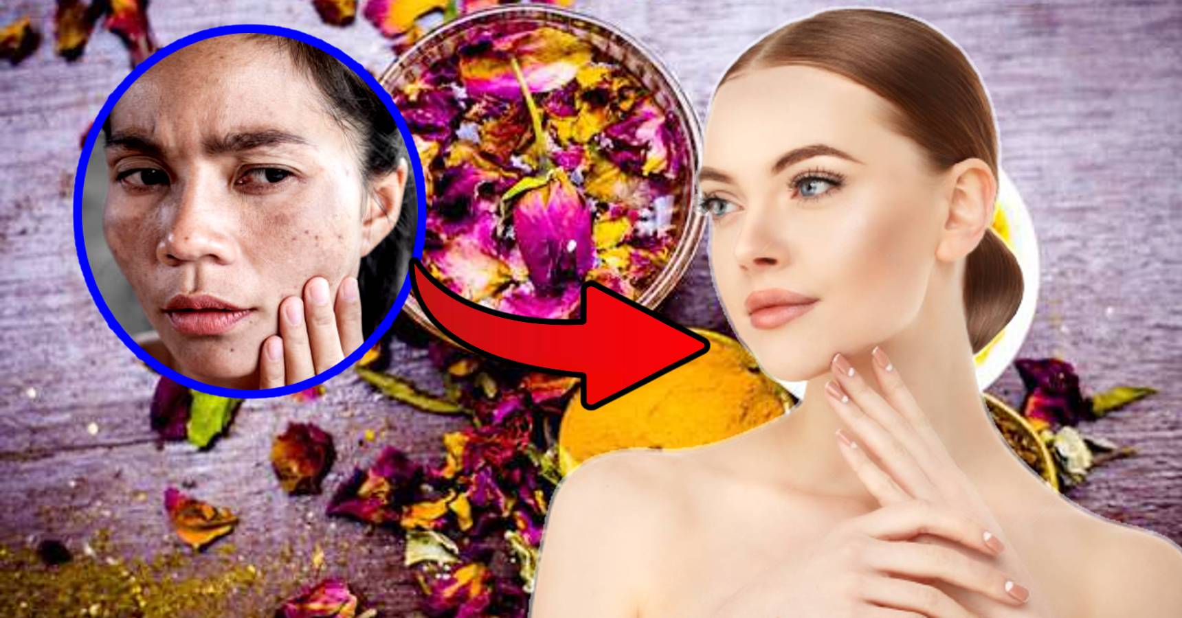 This homemade face pack can easily cure skin pigmentation