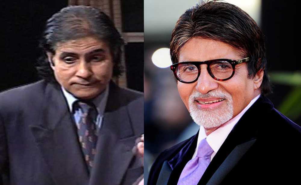 Amitabh Bacchan before after hair transplant