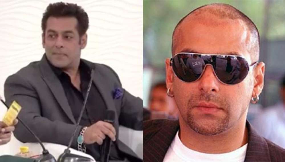 Salman Khan before after Hair Transplant