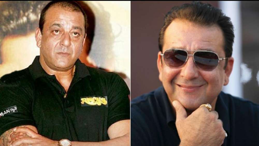 Sanjay Dutt before after look of hair transplant